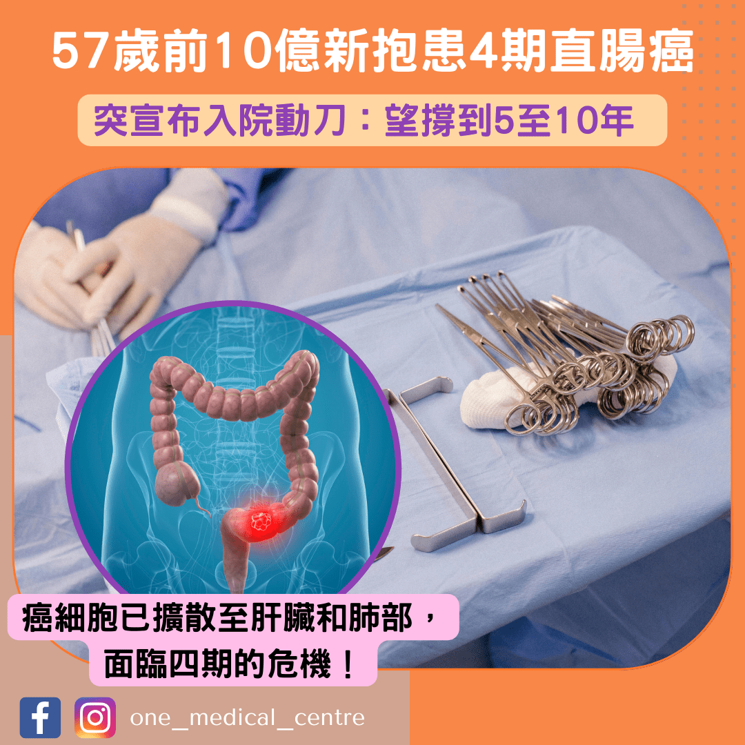 【57歲前10億新抱患4期直腸癌　突宣布入院動刀：望撐到5至10年】